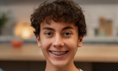 braces vs lingual braces