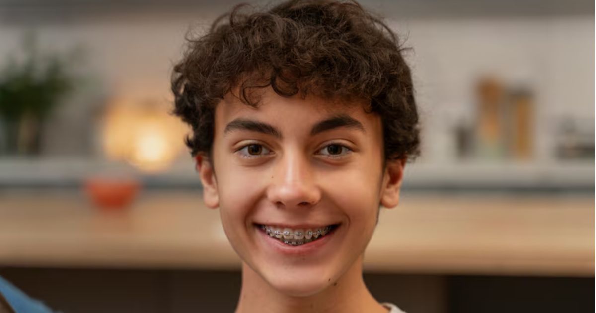 braces vs lingual braces